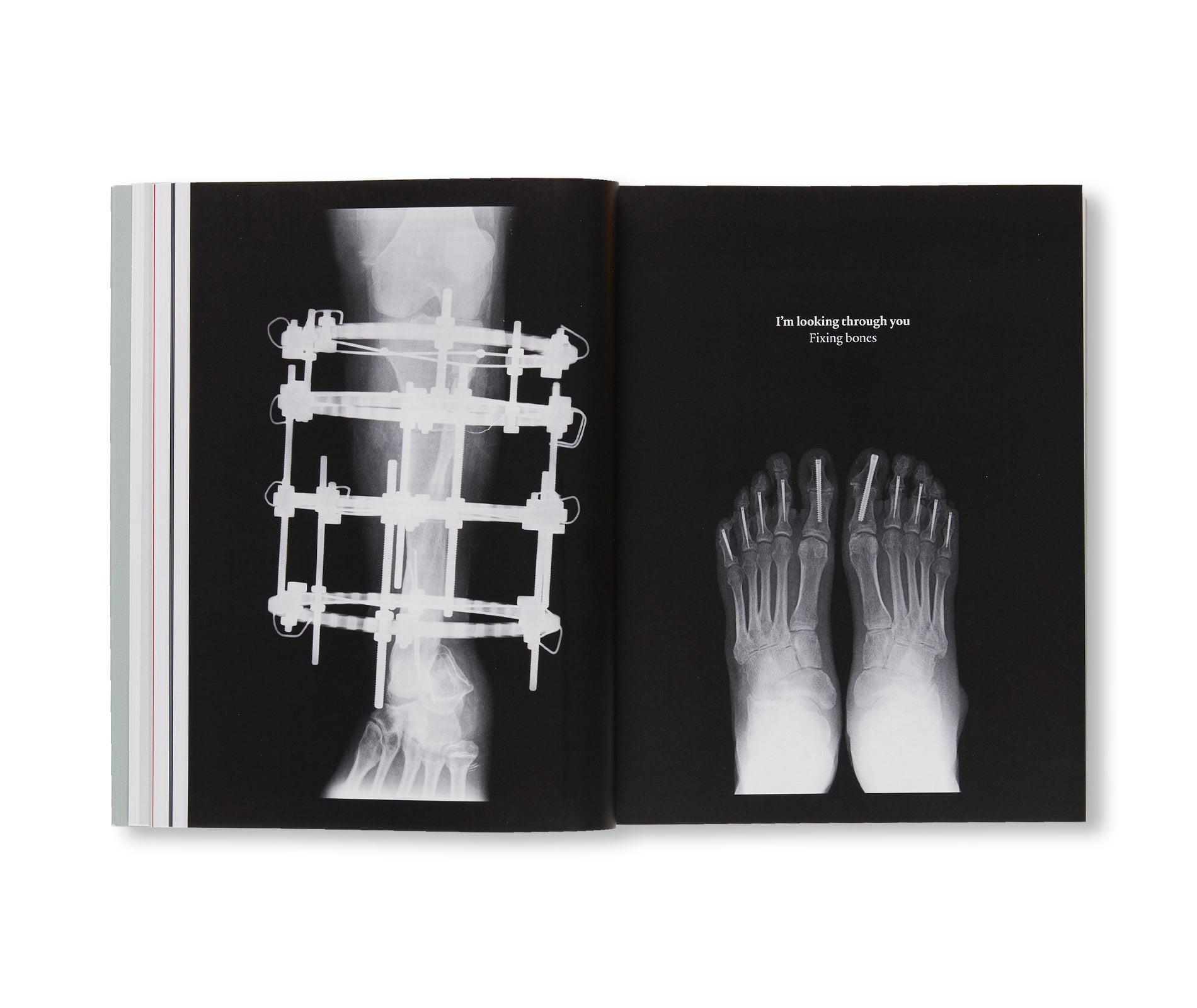 U-JOINTS - A TAXONOMY OF CONNECTIONS